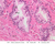 b91 prostate adult 40x he labeled.jpg