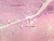 b98 cervix vagina junction 2x labeled.jpg