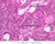 b94 early primary follicle 40x labeled.jpg
