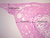 b93a uterus 1x labeled.jpg
