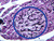 b39 capillary beds pancreas 20x ink he labeled.jpg