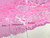 b1 esophageocardiac junction 2x labeled.jpg