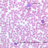 A100, Blood Smear, 40x Labeled (Wright)