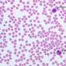 A100, Blood Smear, 40x Labeled (Wright)