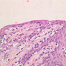 B98, Uterine Cervix, 40x (H&E)