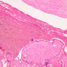 A96, Placenta (Term), 10x (H&E)