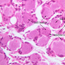 A90, Dorsal Root Ganglion, 40x Labeled (H&E)