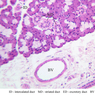 B44, Submandibular Gland, 20x Labeled (H&E)