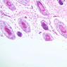 A49, Scalp (Embryo), 10x (H&E)