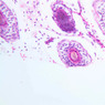 A49, Scalp (Embryo), 20x (H&E)